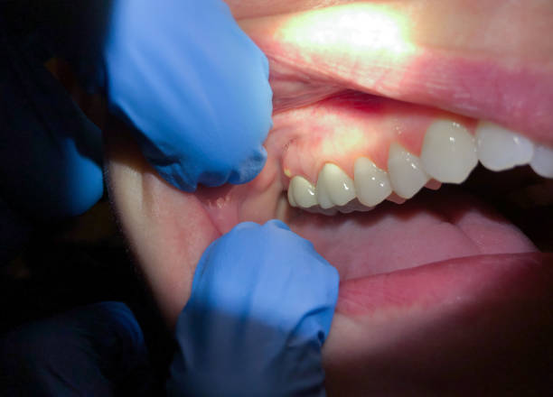 Best Holiday Emergency Dentist in Upper Lake, CA