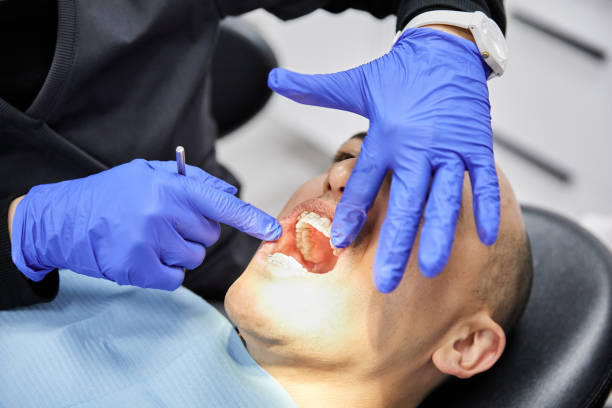 Best Emergency Dental Care for Abscessed Tooth in Upper Lake, CA