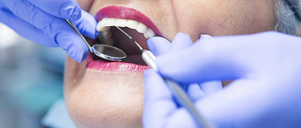 Best Orthodontic Emergency Dentist in Upper Lake, CA
